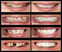 CARILLA DENTAL